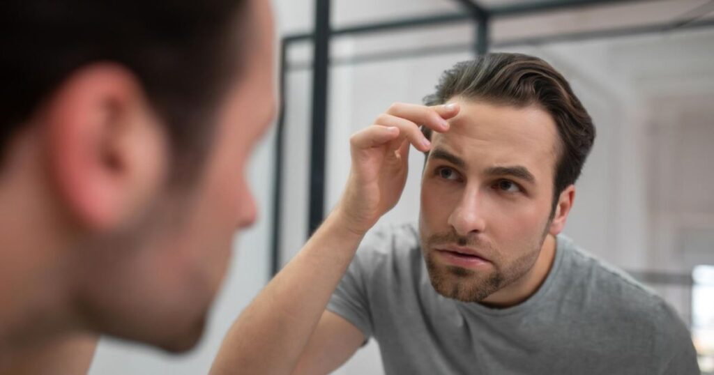 What Is a Hair System